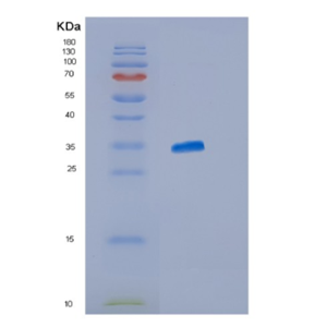 Recombinant Human ISG15 Protein,Recombinant Human ISG15 Protein