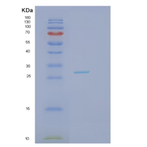 Recombinant Human JAZF1 Protein,Recombinant Human JAZF1 Protein