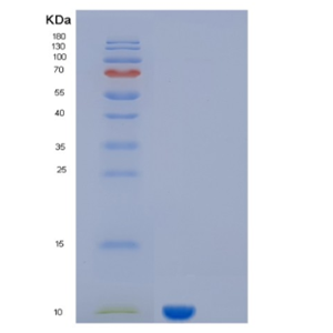 Recombinant Human KAAG1 Protein,Recombinant Human KAAG1 Protein