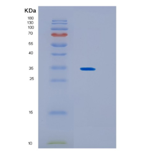 Recombinant Human KCTD4 Protein,Recombinant Human KCTD4 Protein