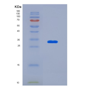 Recombinant Human Ketohexokinase Protein,Recombinant Human Ketohexokinase Protein