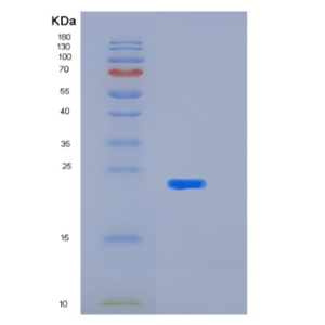 Recombinant Human KIR2DL1(p58 KIR Protein