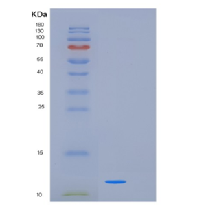 Recombinant Human KISS1 Protein