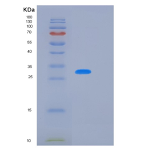 Recombinant Human KLK10 Protein,Recombinant Human KLK10 Protein