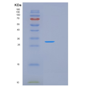 Recombinant Human KLK2 Protein,Recombinant Human KLK2 Protein