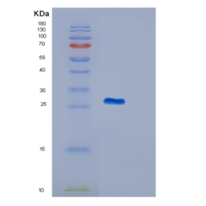 Recombinant Human ITGB1BP3 Protein,Recombinant Human ITGB1BP3 Protein