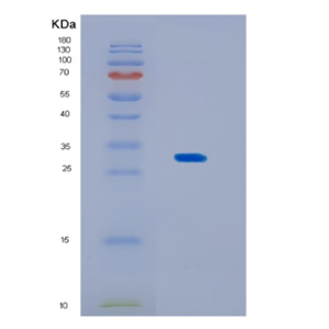 Recombinant Human KCTD15 Protein,Recombinant Human KCTD15 Protein