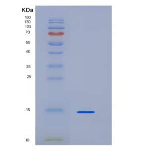 Recombinant Human KIAA0101 Protein