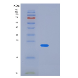 Recombinant Human KIR2DS4(p50 KIR Protein