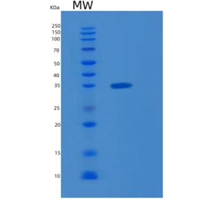 Recombinant Human KLF6 Protein,Recombinant Human KLF6 Protein