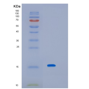 Recombinant Human KCNMB3 Protein