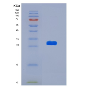 Recombinant Human KDSR Protein,Recombinant Human KDSR Protein