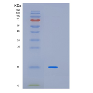 Recombinant Human KIR3DL1(Cytoplasmic tail Protein,Recombinant Human KIR3DL1(Cytoplasmic tail Protein