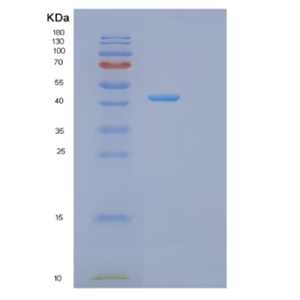 Recombinant Human ITPK1 Protein,Recombinant Human ITPK1 Protein