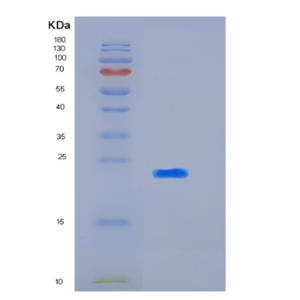 Recombinant Human KIR2DL3(p58 KIR Protein,Recombinant Human KIR2DL3(p58 KIR Protein