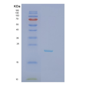 Recombinant Human JDP2 Protein