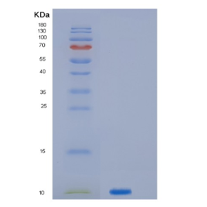 Recombinant Human JTB Protein,Recombinant Human JTB Protein