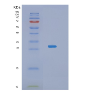 Recombinant Human KCTD11 Protein,Recombinant Human KCTD11 Protein