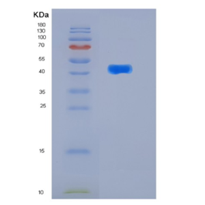 Recombinant Human KIN17 Protein,Recombinant Human KIN17 Protein