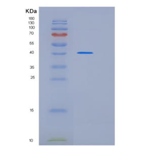 Recombinant Human KLF3 Protein,Recombinant Human KLF3 Protein