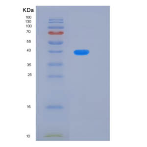 Recombinant Human KLHDC8B Protein,Recombinant Human KLHDC8B Protein