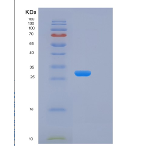 Recombinant Human KLK15 Protein