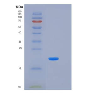 Recombinant Human KLK7 Protein,Recombinant Human KLK7 Protein