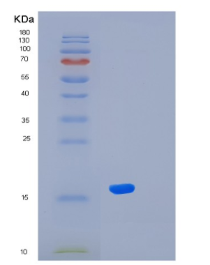 Recombinant Human KLRG1 Protein,Recombinant Human KLRG1 Protein