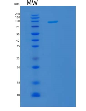 Recombinant Human KPNB1 Protein,Recombinant Human KPNB1 Protein