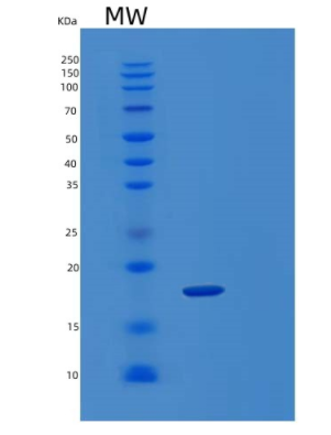 Recombinant Human KLRC2 Protein,Recombinant Human KLRC2 Protein