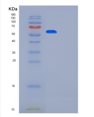 Recombinant Human KPNA2 Protein,Recombinant Human KPNA2 Protein