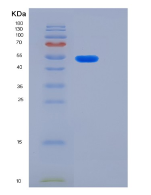 Recombinant Human KRT14 Protein,Recombinant Human KRT14 Protein