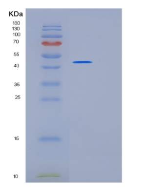 Recombinant Human KRT19 Protein,Recombinant Human KRT19 Protein