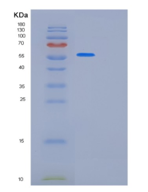 Recombinant Human KRT8 Protein,Recombinant Human KRT8 Protein