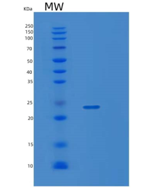 Recombinant Human KRAS Protein,Recombinant Human KRAS Protein