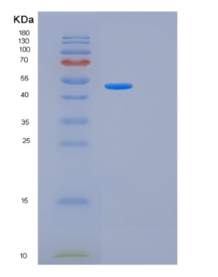 Recombinant Human KRT20 Protein,Recombinant Human KRT20 Protein