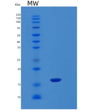 Recombinant Human LAGE3 Protein,Recombinant Human LAGE3 Protein