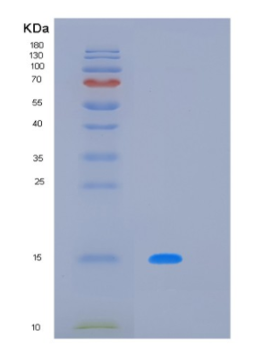 Recombinant Human LAIR2 Protein,Recombinant Human LAIR2 Protein