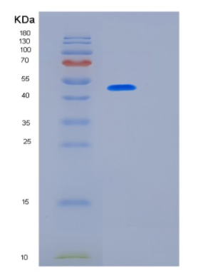 Recombinant Human KRT17 Protein,Recombinant Human KRT17 Protein