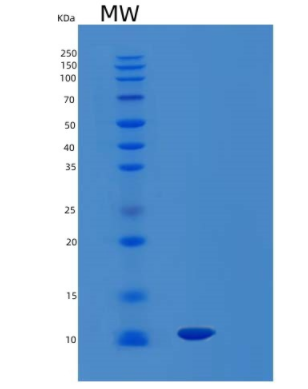 Recombinant Human LAIR-1( Extracellular domain ; 22-125aa Protein,Recombinant Human LAIR-1( Extracellular domain ; 22-125aa Protein