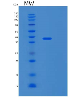 Recombinant Human LAMP3 Protein,Recombinant Human LAMP3 Protein