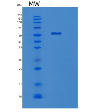 Recombinant Human KRT16 Protein,Recombinant Human KRT16 Protein