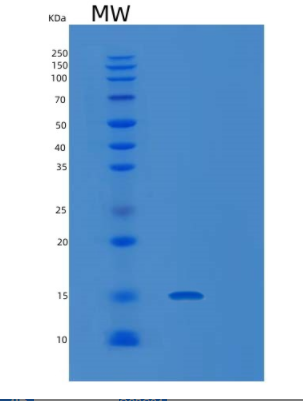 Recombinant Mouse Lair1 Protein,Recombinant Mouse Lair1 Protein