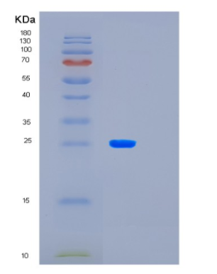 Recombinant Human LAYN Protein,Recombinant Human LAYN Protein