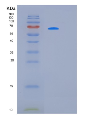 Recombinant Human KRT5 Protein,Recombinant Human KRT5 Protein