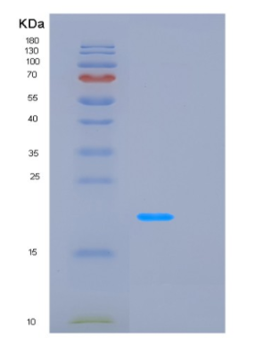 Recombinant Human LCN2 Protein,Recombinant Human LCN2 Protein