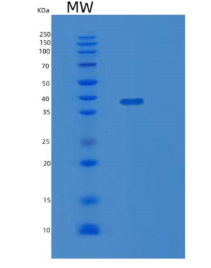 Recombinant Human LDHA Protein,Recombinant Human LDHA Protein