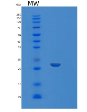 Recombinant Human KXD1 Protein,Recombinant Human KXD1 Protein