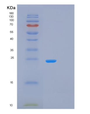 Recombinant Human LAT Protein,Recombinant Human LAT Protein