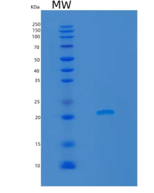 Recombinant Rat Lcn2 Protein,Recombinant Rat Lcn2 Protein